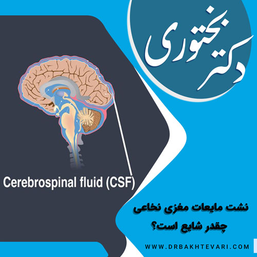نشت مایعات مغزی (CSF) چیست؟