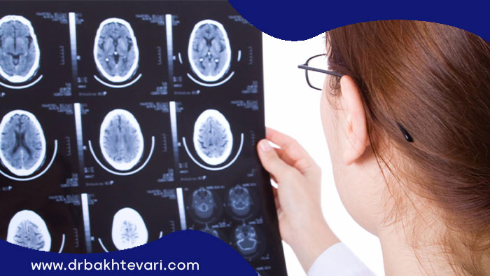 تشخیص بیماری تومور بدخیم با معاینه عصبی مغز