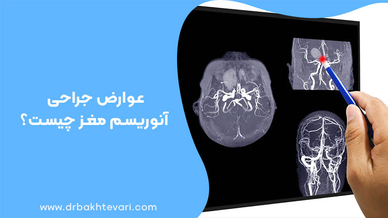 عوارض جراحی آنوریسم مغز که دکتر نشان می‌دهد