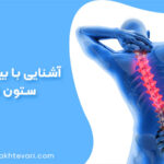 آشنایی با بیماری های ستون فقرات