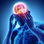 فشار مغز ( فشار بالا داخل جمجمه )