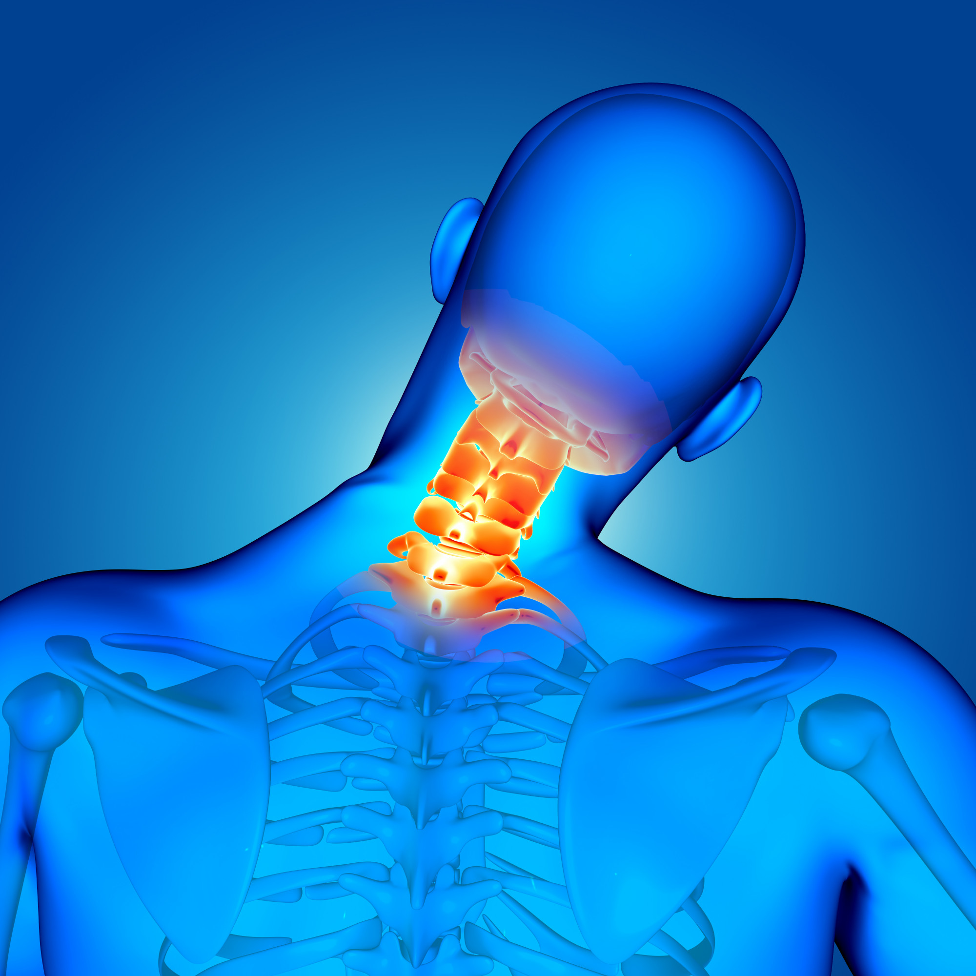 تنگی کانال گردن : علت، علائم، تشخیص و درمان آن