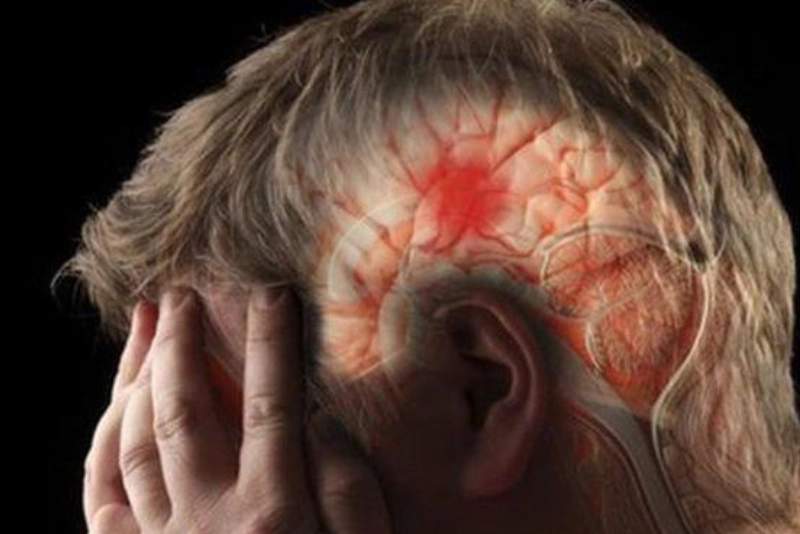 لخته خون در مغز چرا اتفاق می افتد؟