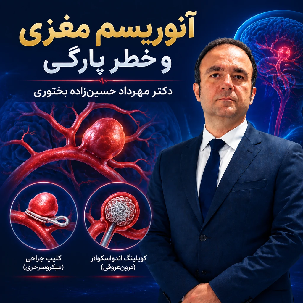 آنوریسم مغزی و خطر پارگی+تفاوت جراحی کلیپس و کویل‌گذاری
