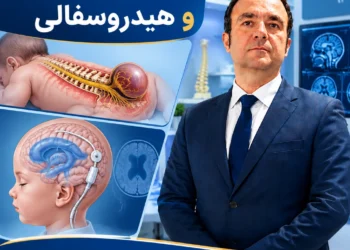 میلومننگوسل و هیدروسفالی در کودکان و بزرگسالان