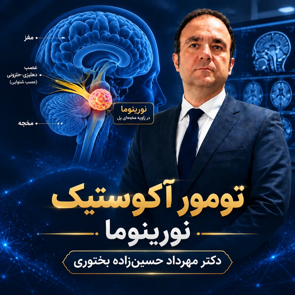 تومور آکوستیک نورینوما چیست؟ علائم، افت شنوایی، سرگیجه و درمان‌های دارویی تا جراحی